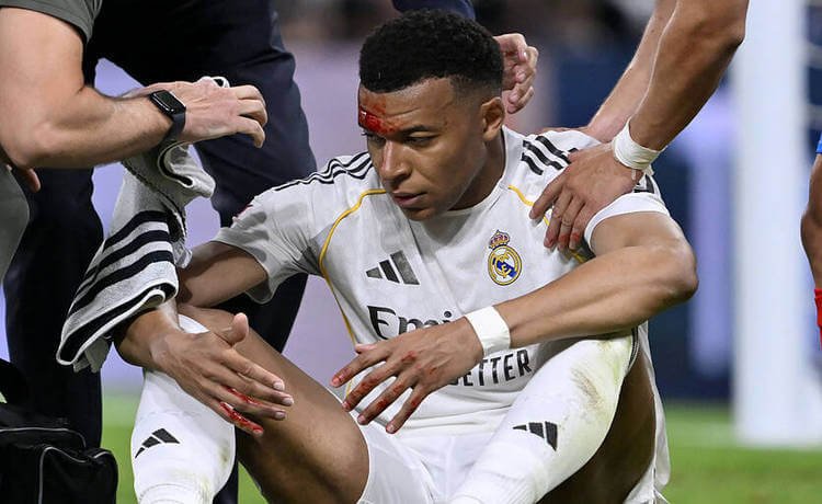 Известно, готов ли Мбаппе к матчу ЛЧ после рассечения брови